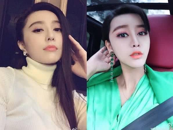 爆料闺蜜帮整容视频,揭秘网红整容视频背后的真实故事  第2张